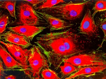 Endothelial cells Courtesy of Nikon Small Worlds